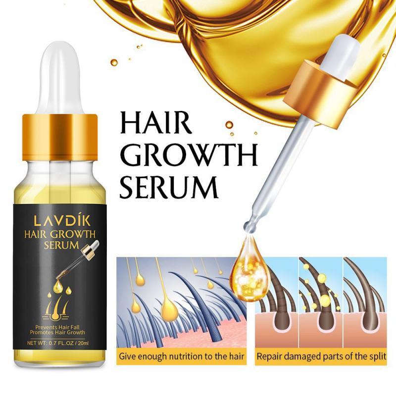 Hair Loss Prevention - Rapid & Natural Hair Growth solution in a 20ml bottle, featuring natural ingredients for hair nourishment.