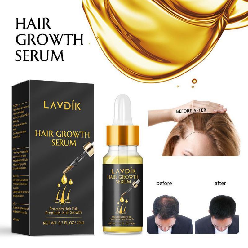 Hair Loss Prevention - Rapid & Natural Hair Growth solution in a 20ml bottle, featuring natural ingredients for hair nourishment.