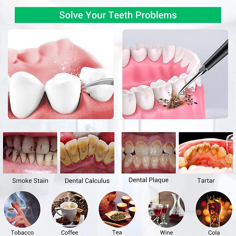 Ultrasonic Tooth Cleaner with stainless steel tips and USB charging cable, designed for effective dental care and stone removal.