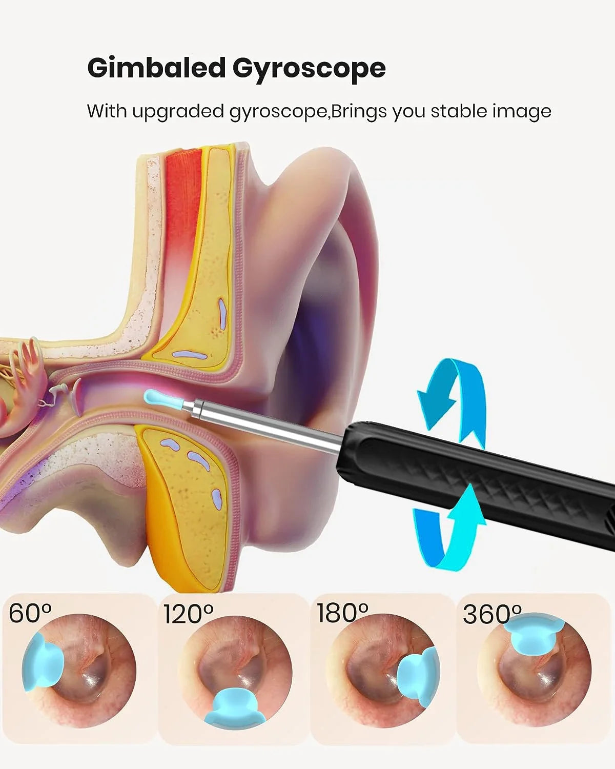 Ear Wax Removal Tool featuring a 1296P HD camera and silicone ear spoons, designed for effective ear cleaning.