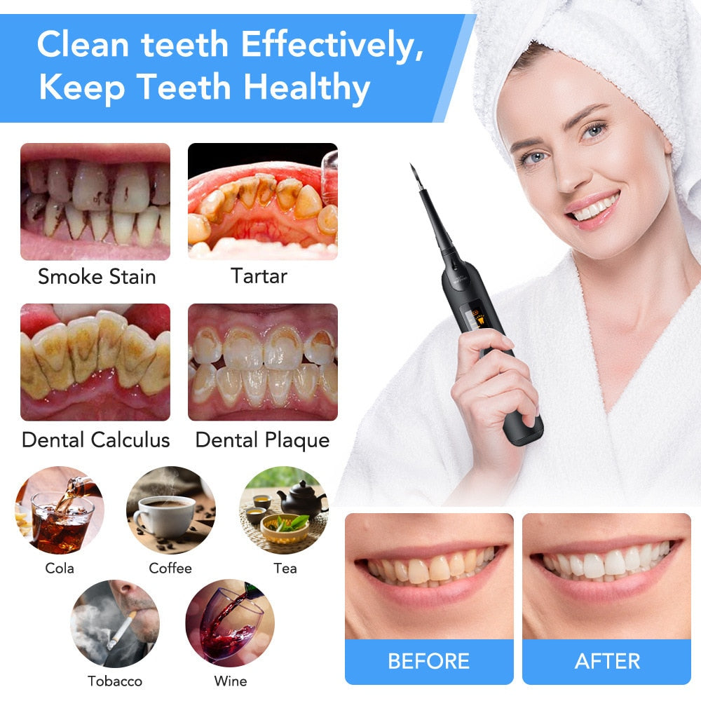 Electric Dental Calculus Remover with LED display and various cleaning tips, showcasing its sleek design and functionality.