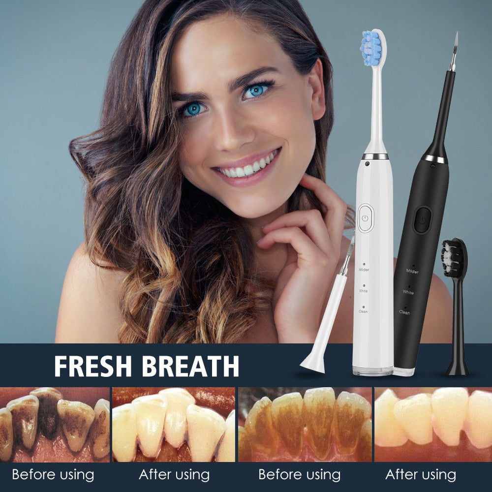 Electric Dental Scaler Teeth Whitening Device with multiple brush heads and USB charging cable, designed for effective teeth cleaning.