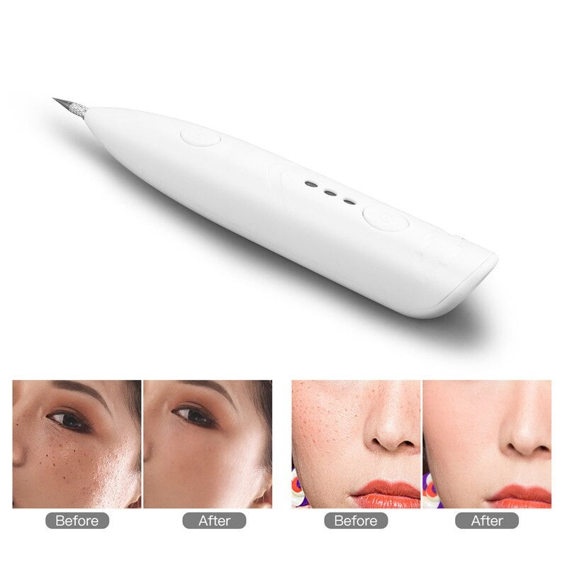 Electric Mini Laser Pen for tattoo mole removal, featuring adjustable settings and multiple needle options for effective skin care.