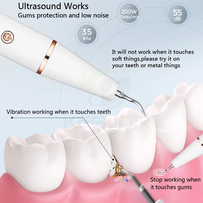 Electric Sonic Dental Calculus Scaler with ergonomic design and LED light for effective teeth cleaning.