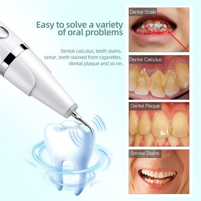 Electric Sonic Dental Whitener Scaler with multiple tips and USB charging cord, designed for effective teeth cleaning and tartar removal.