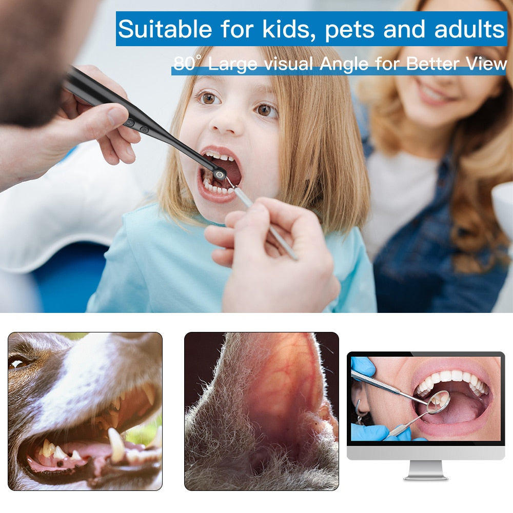 Intraoral Dental Camera Endoscope with USB connection, showcasing its ergonomic design and adjustable LED lights.