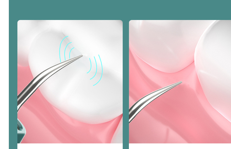 High-definition visual dental cleaner with USB charging and LED lights, designed for effective plaque and tartar removal.