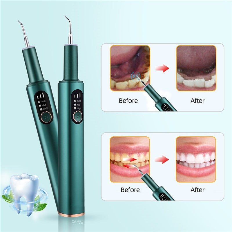 Portable Electric Sonic Dental Calculus Scaler with stainless steel tips and charging cable, designed for effective tartar removal.