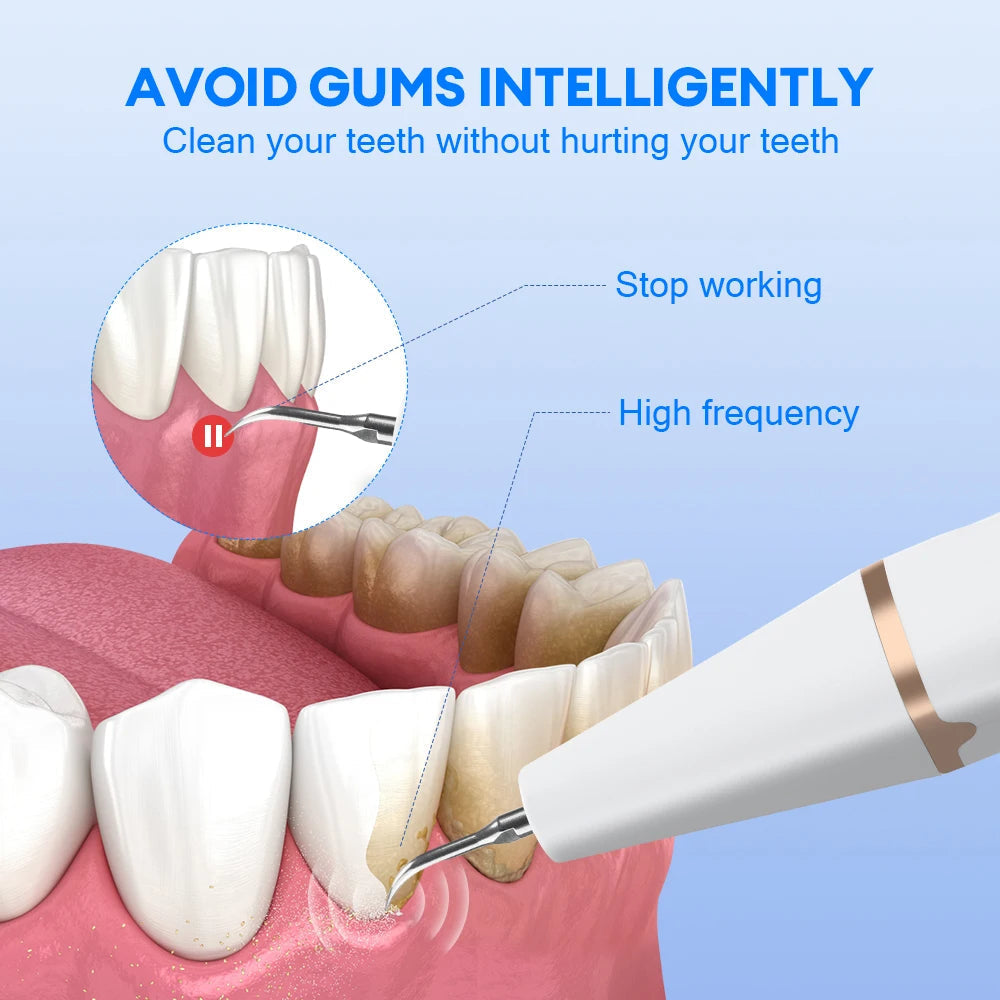 Ultrasonic Dental Scaler with cleaning tips and USB charging cable, designed for effective tartar removal and oral hygiene.