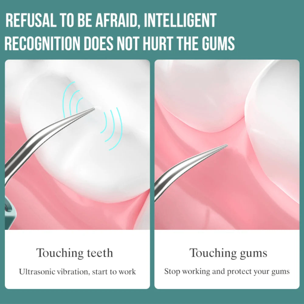 Visual Ultrasonic Dental Scaler with ergonomic design and display for effective tartar and stain removal.