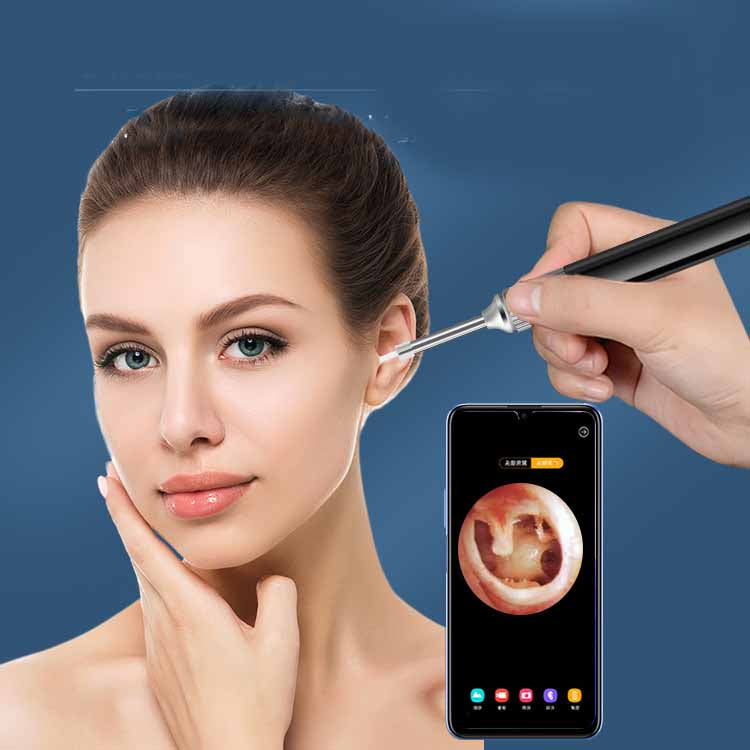 WiFi Otoscope Ear Cleaner with HD camera and LED lights, designed for safe ear cleaning and inspection.