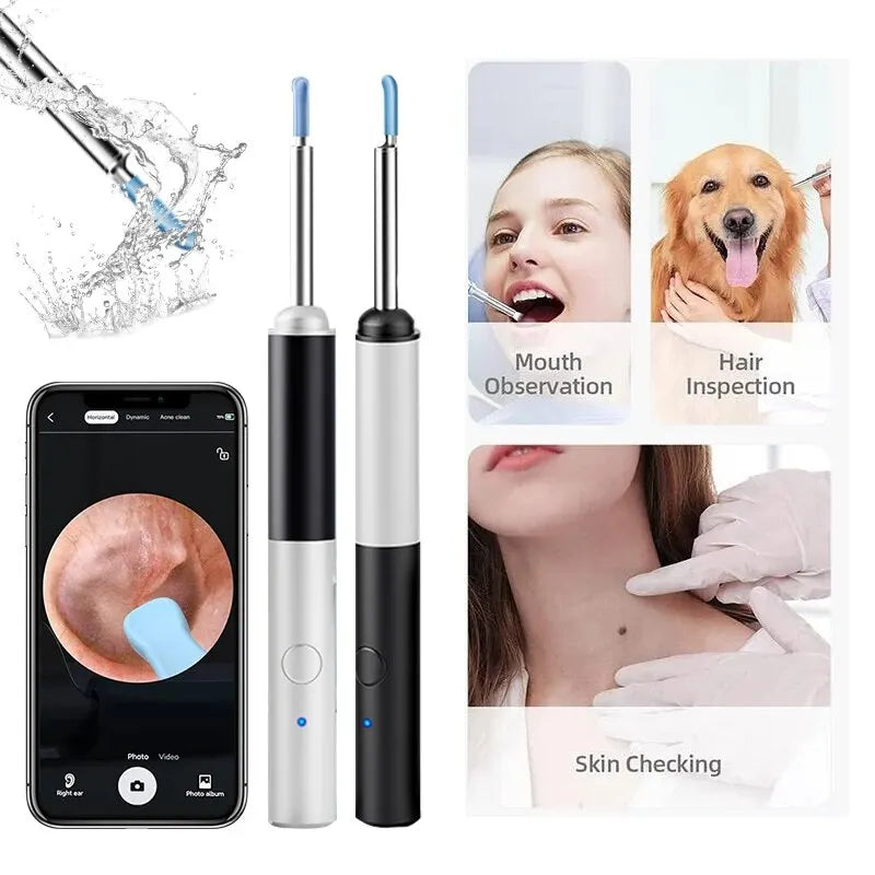 Wireless Otoscope 3.5mm Ultra-Thin WiFi Ear Scope Camera with earwax removal tool and LED lights, designed for safe ear cleaning.