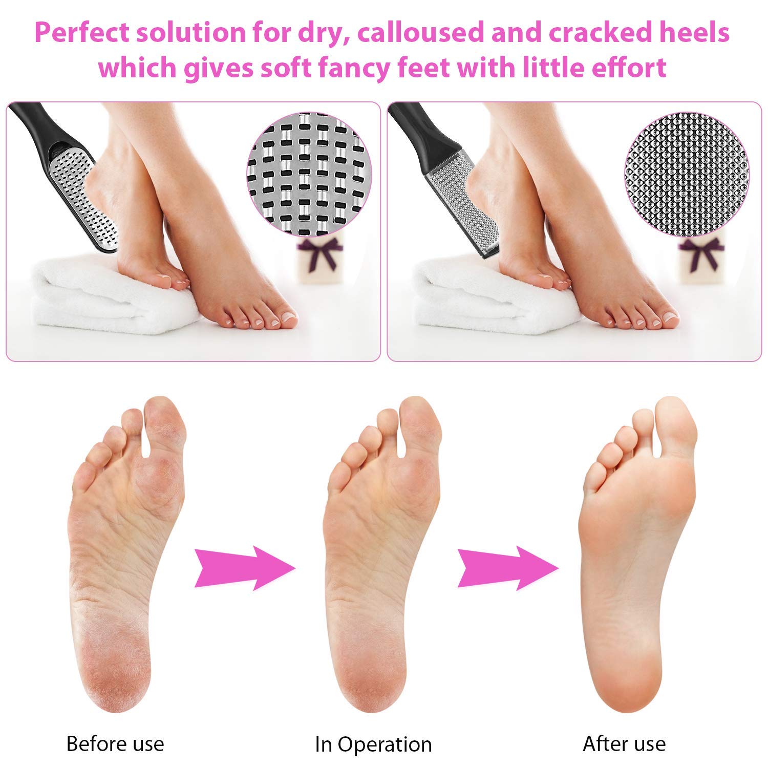 23 in 1 Pedicure Kit featuring various professional tools for foot care, including files, clippers, and a storage box.