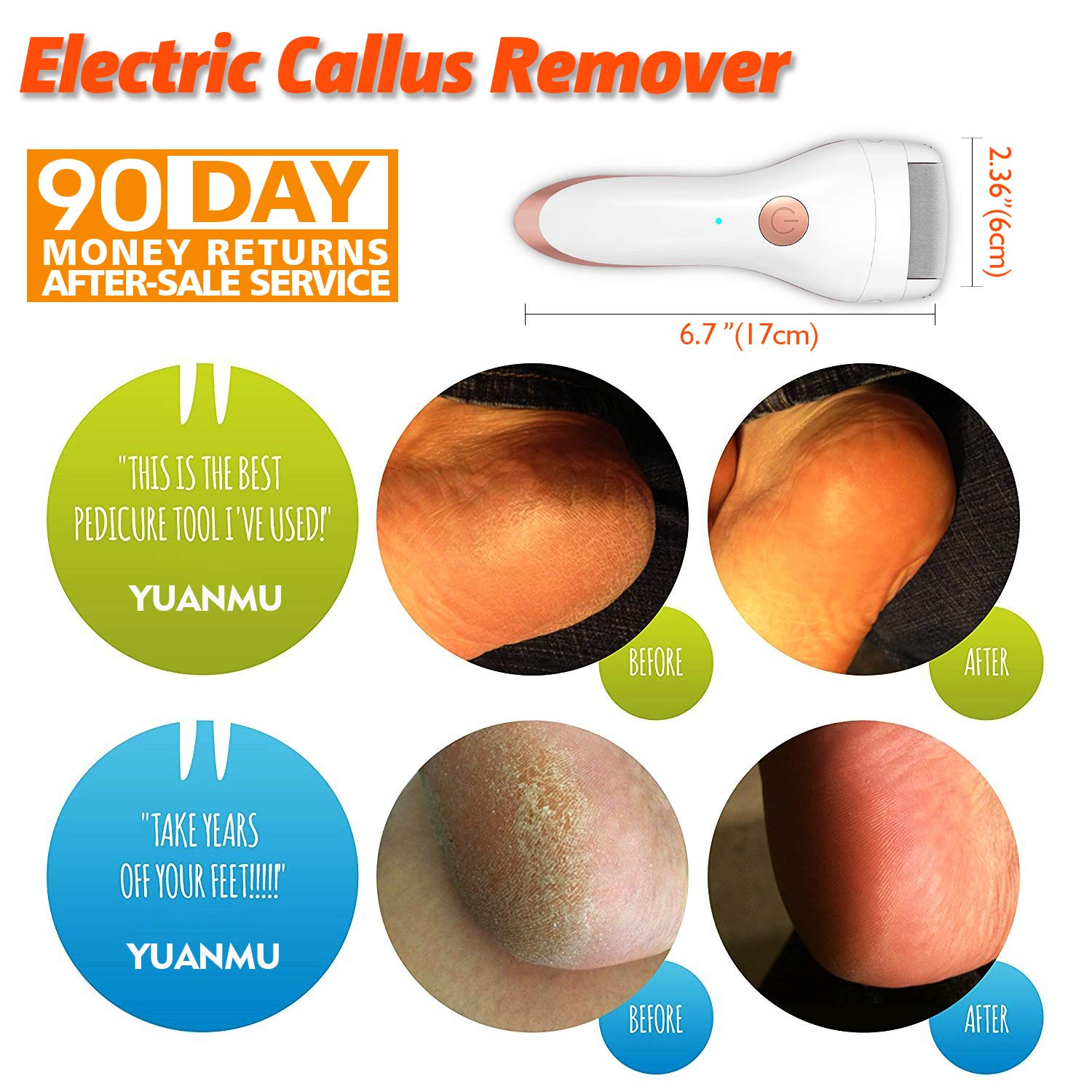 Electric Foot Callus Remover with three roller heads, USB rechargeable, and waterproof design for effective foot care.