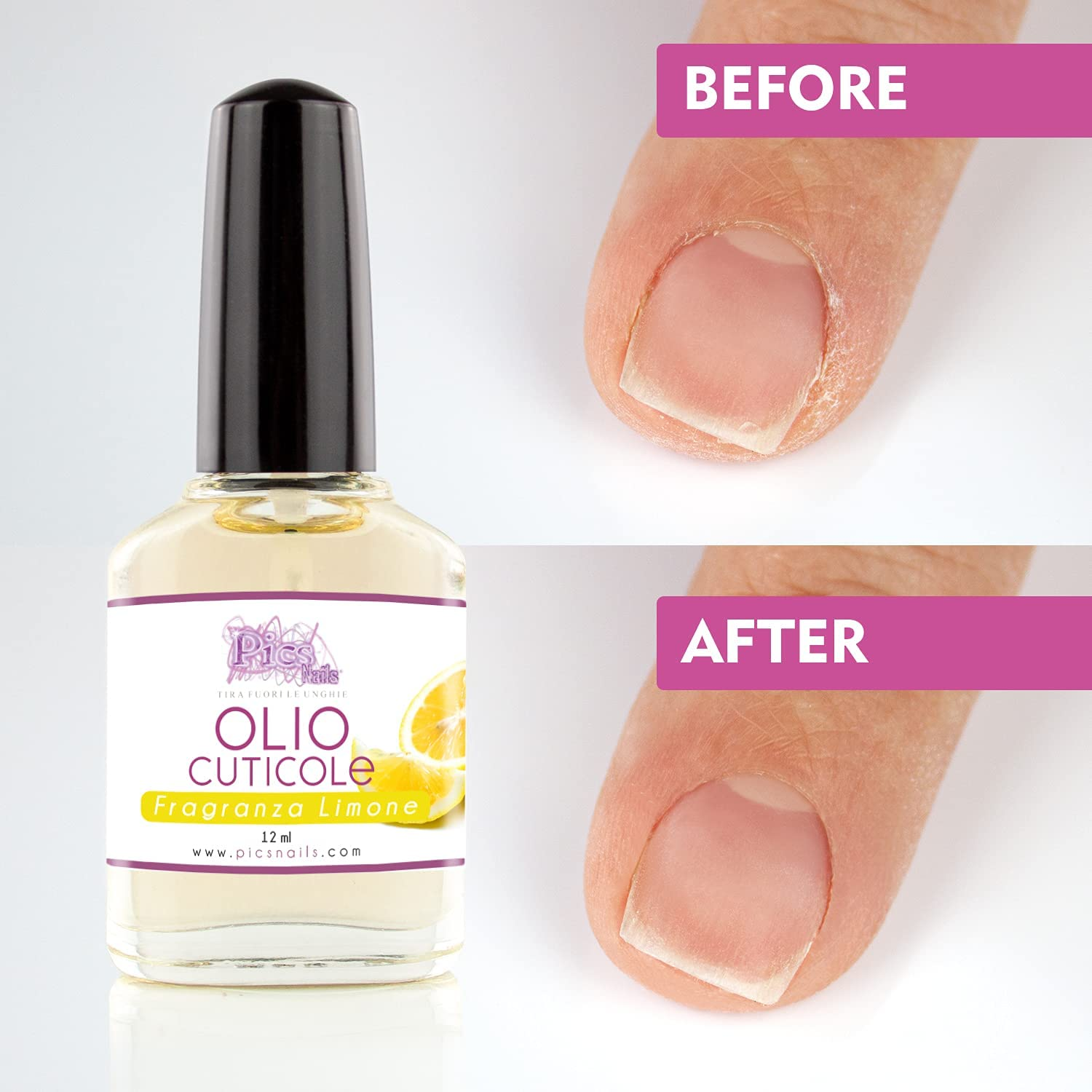 Flacone di Olio Cuticole Unghie per Mani e Piedi Professionale Limone 12 ml, con applicatore Roll On e fragranza al limone.