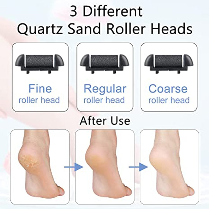 Portable Electric Foot File Callus Remover with USB charging and quartz sanding heads, designed for effective foot care.