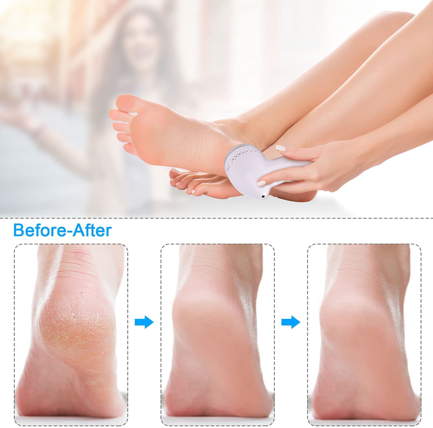 Portable Electric Grinder Pedicure Tool with three sanding heads and accessories for foot care.