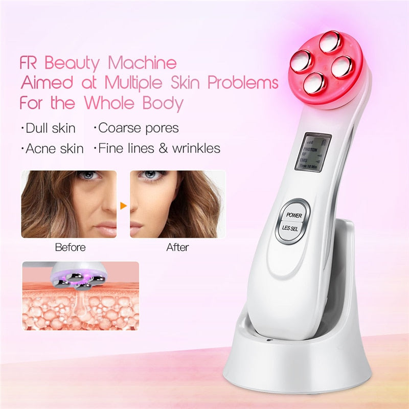 5in1 RF&EMS Radio Mesotherapy Electroporation Face Beauty Pen in white color, showcasing its sleek design and multifunctional features for skincare.