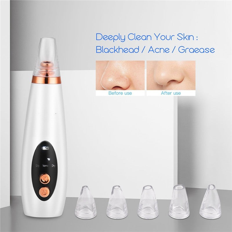 6 In 1 Electric Facial Blackhead Remover with multiple tips and USB charging cable, designed for deep pore cleaning and skincare.