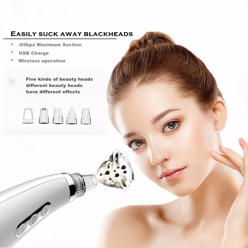 Blackhead Remover Vacuum with multiple suction heads and ergonomic design for effective pore cleansing.