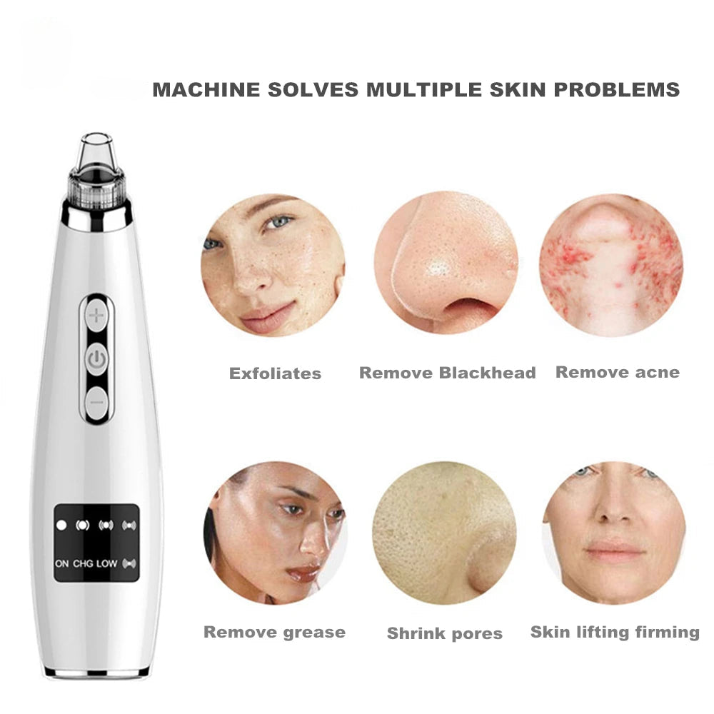 Blackhead Remover Vacuum with multiple suction heads and ergonomic design for effective pore cleansing.