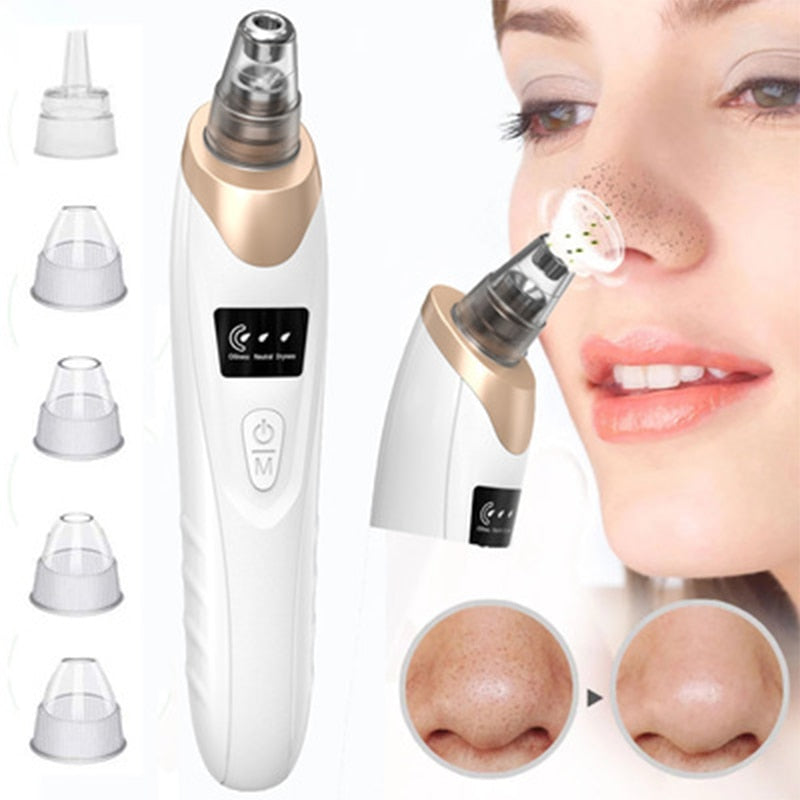 Electric Facial Blackhead Remover Vacuum with multiple replacement heads and USB charging cable, designed for effective acne and blackhead removal.