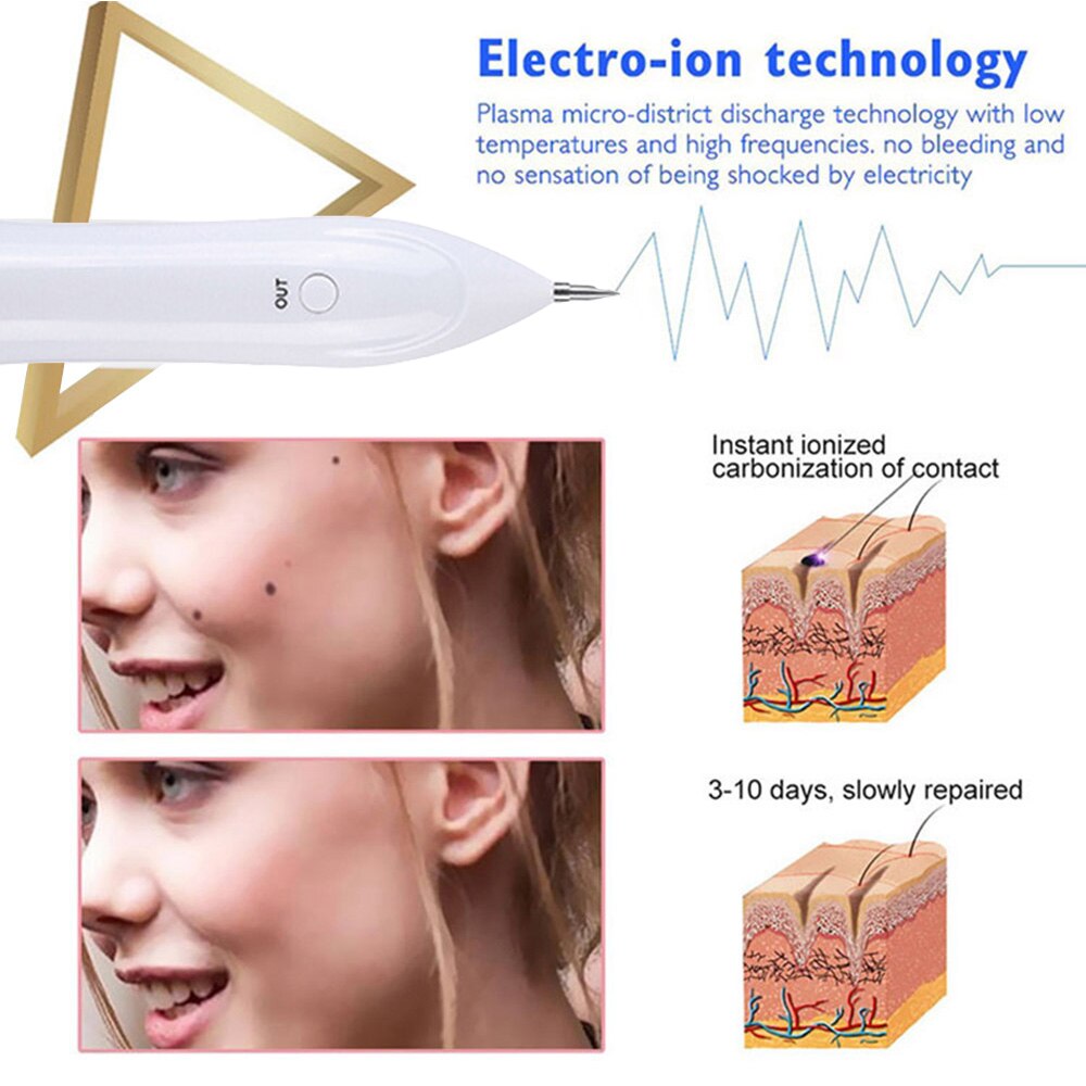 Electric Plasma Jet Pen Freckle Remover Machine in white color, designed for mole and freckle removal with adjustable intensity levels.