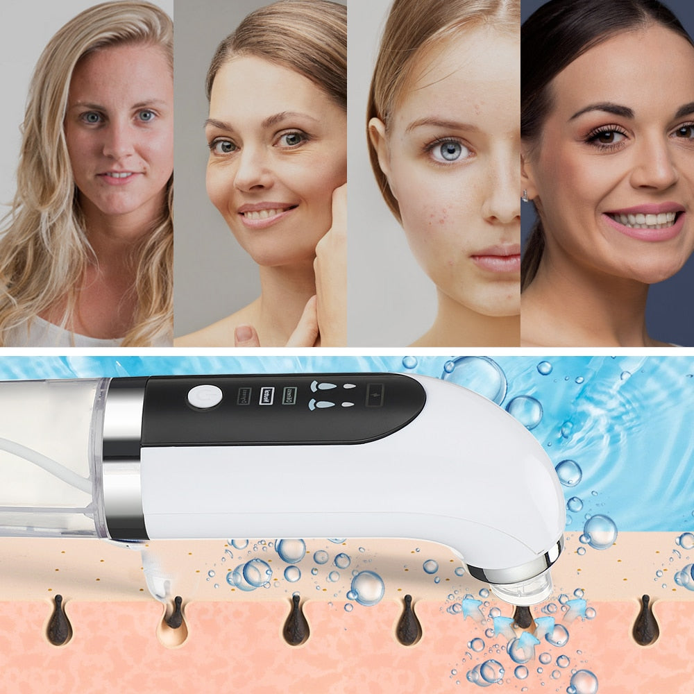 Electric Small Bubble Blackhead Remover with USB charging, featuring multiple suction heads and a sleek design for effective skincare.