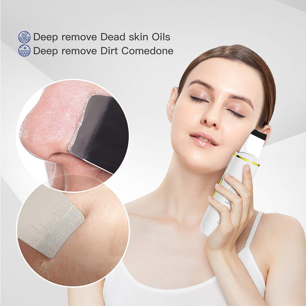 Ultrasonic Cleaner Skin Scrubber in white color, designed for deep facial cleansing and acne treatment, featuring a sleek and compact design.