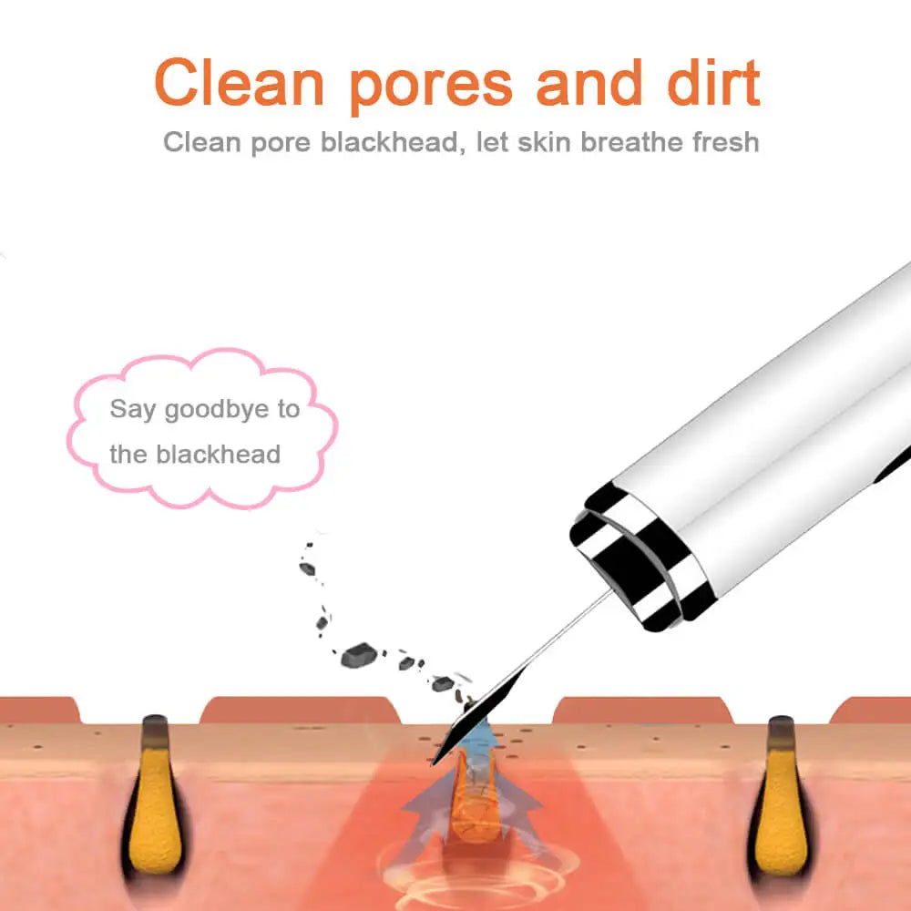 Ultrasonic Skin Scrubber in white and pink colors, designed for deep face cleaning and blackhead removal, featuring a sleek and portable design.