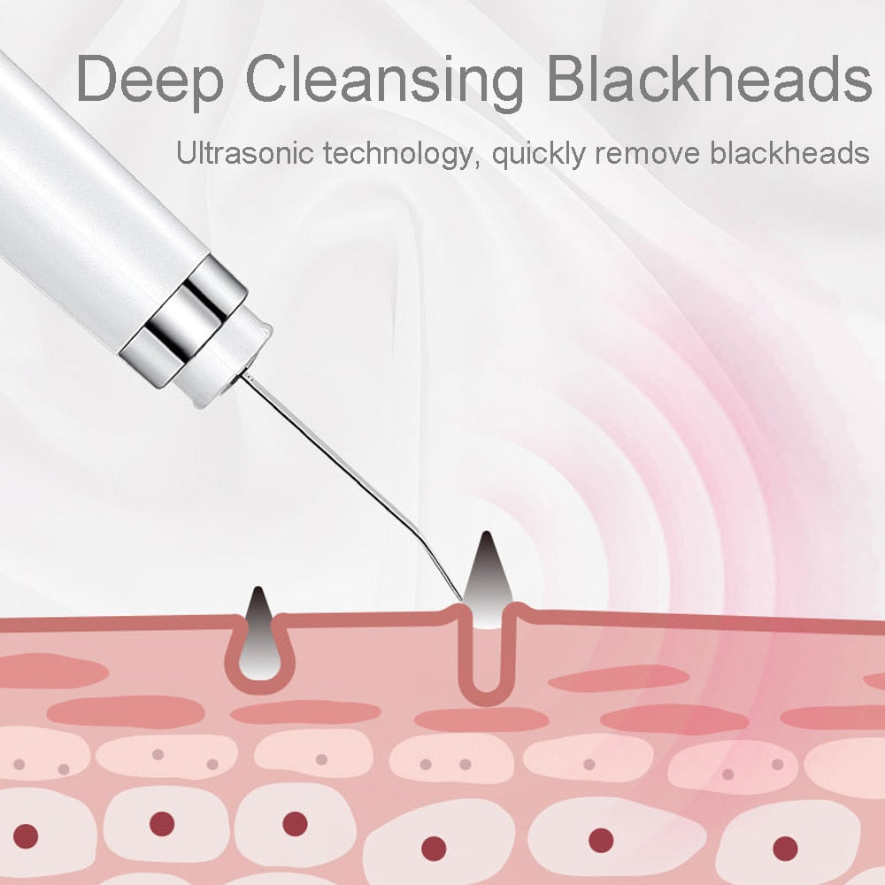 Ultrasonic Skin Scrubber in white and black, designed for deep facial cleansing and rejuvenation.