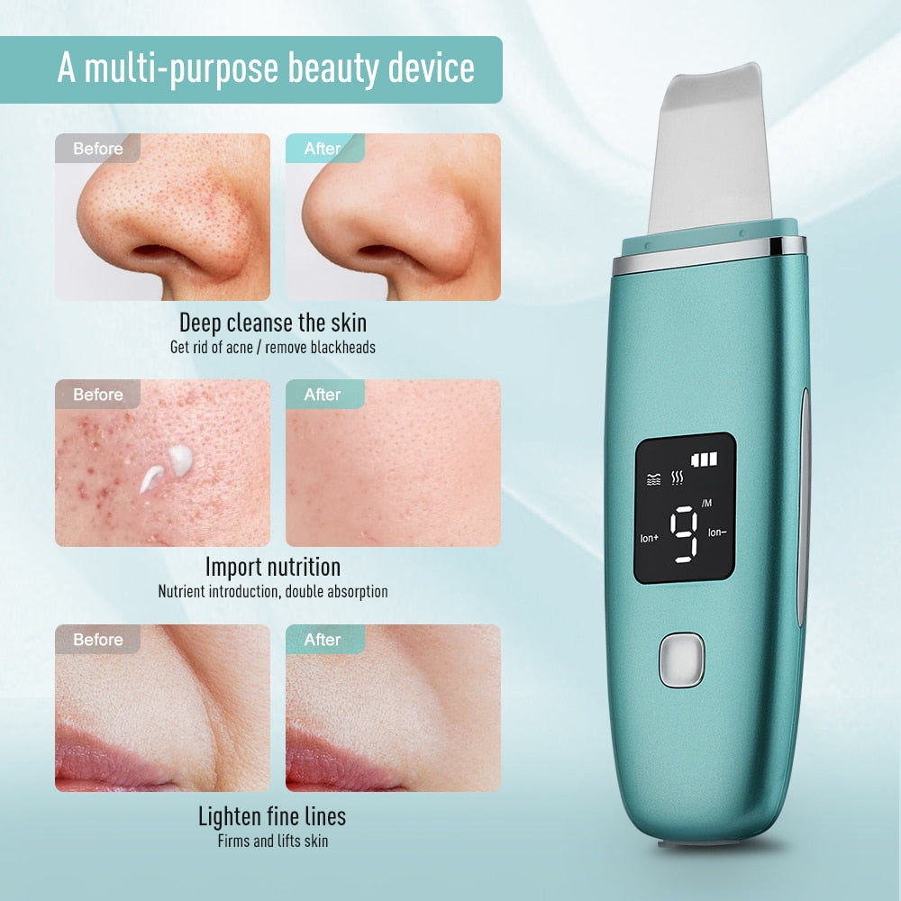 Ultrasonic Skin Scrubber EMS Facial Pore Deep Cleansing device in green color with charging base and accessories.