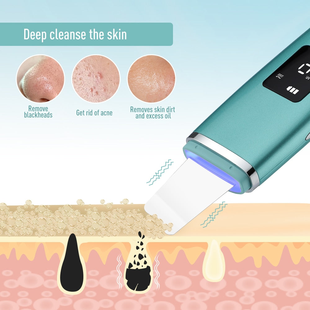 Ultrasonic Skin Scrubber EMS Facial Pore Deep Cleansing device in green color with charging base and accessories.