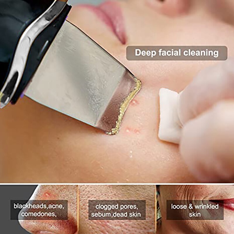 Ultrasonic Skin Scrubber device for deep facial cleansing, featuring a stainless steel scraper and USB charging port.