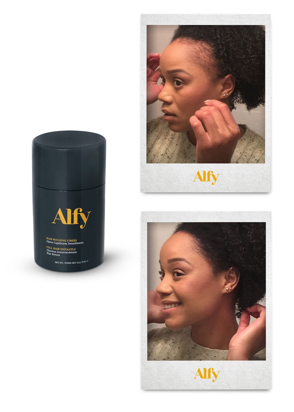 Alfy 12g Starter Kit featuring Hair Building Fibers, Fiber Lock Hair Spray, and Hairline Optimizer for fuller hair.