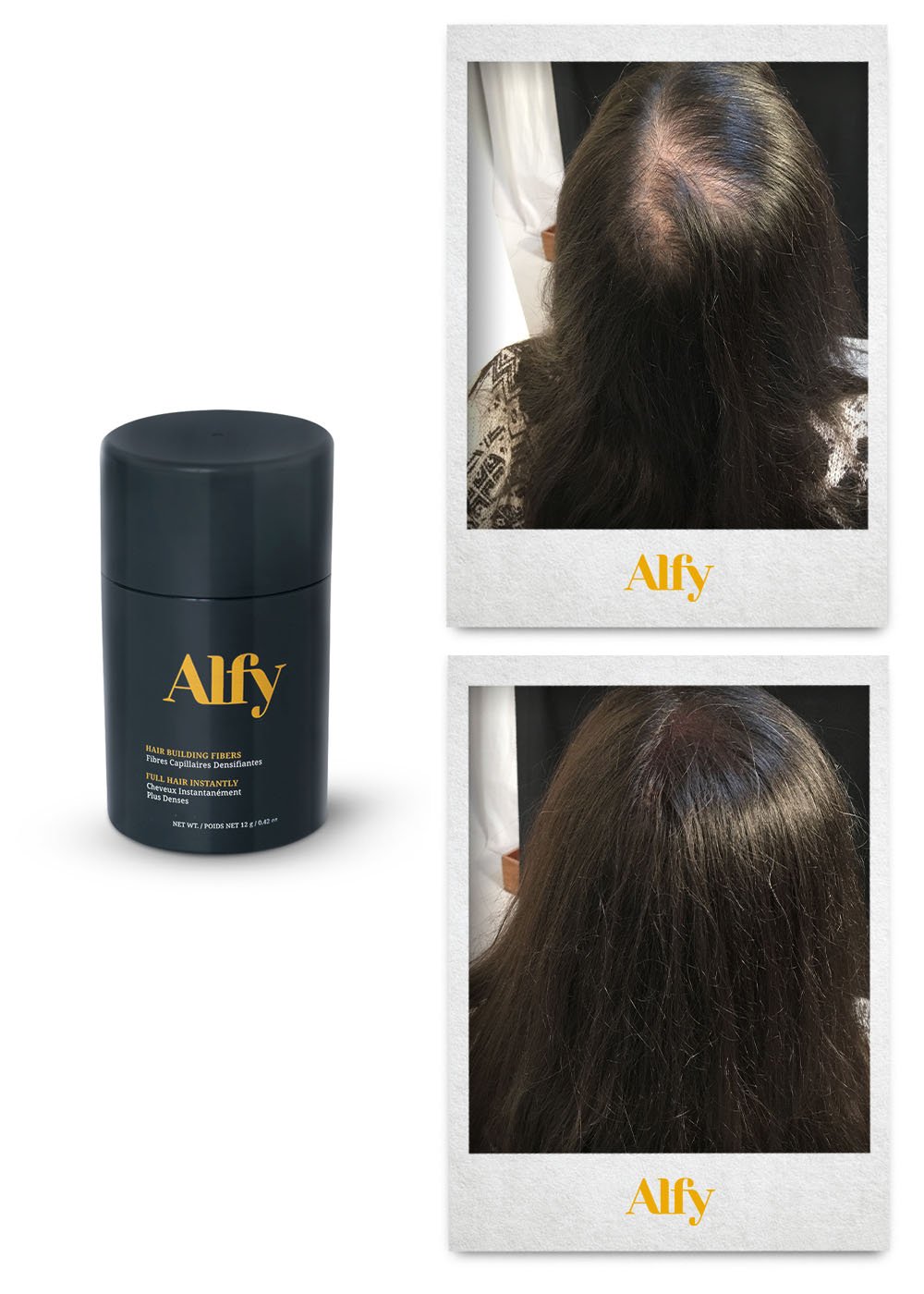 Alfy 12g Starter Kit featuring Hair Building Fibers, Fiber Lock Hair Spray, and Hairline Optimizer for fuller hair.