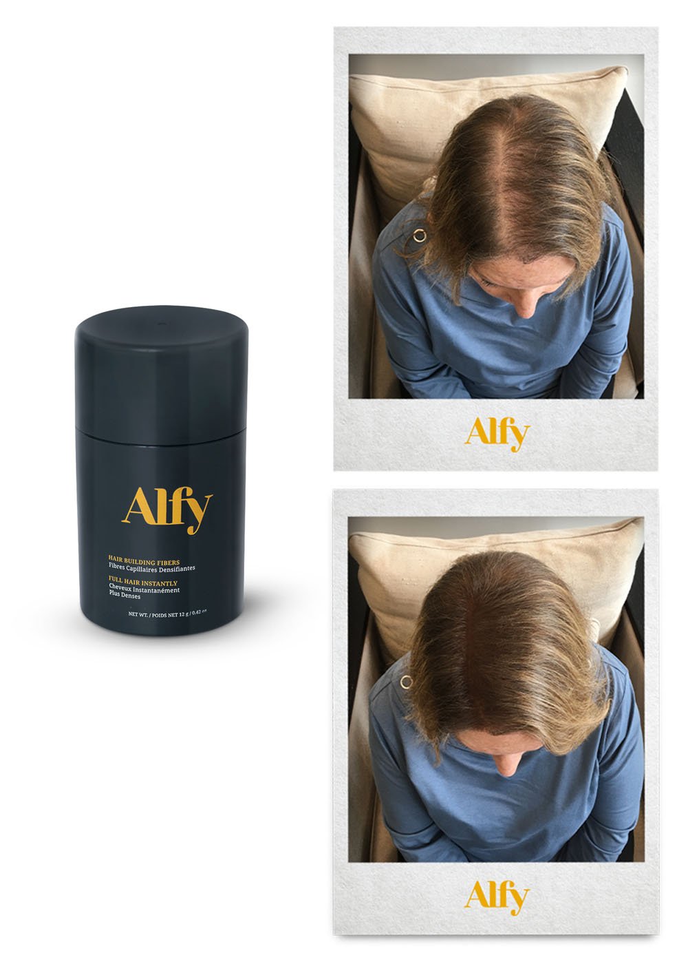 Alfy 12g Starter Kit featuring Hair Building Fibers, Fiber Lock Hair Spray, and Hairline Optimizer for fuller hair.