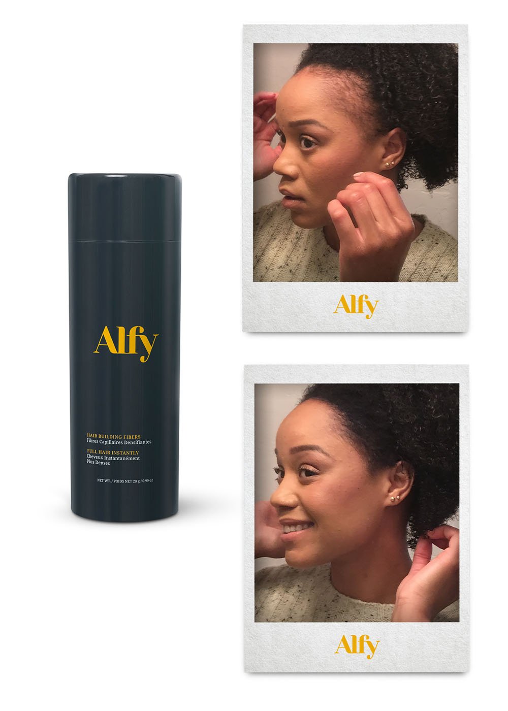 Alfy 28g Starter Kit featuring Hair Building Fibers, Fiber Lock Hair Spray, and Hairline Optimizer for fuller hair.