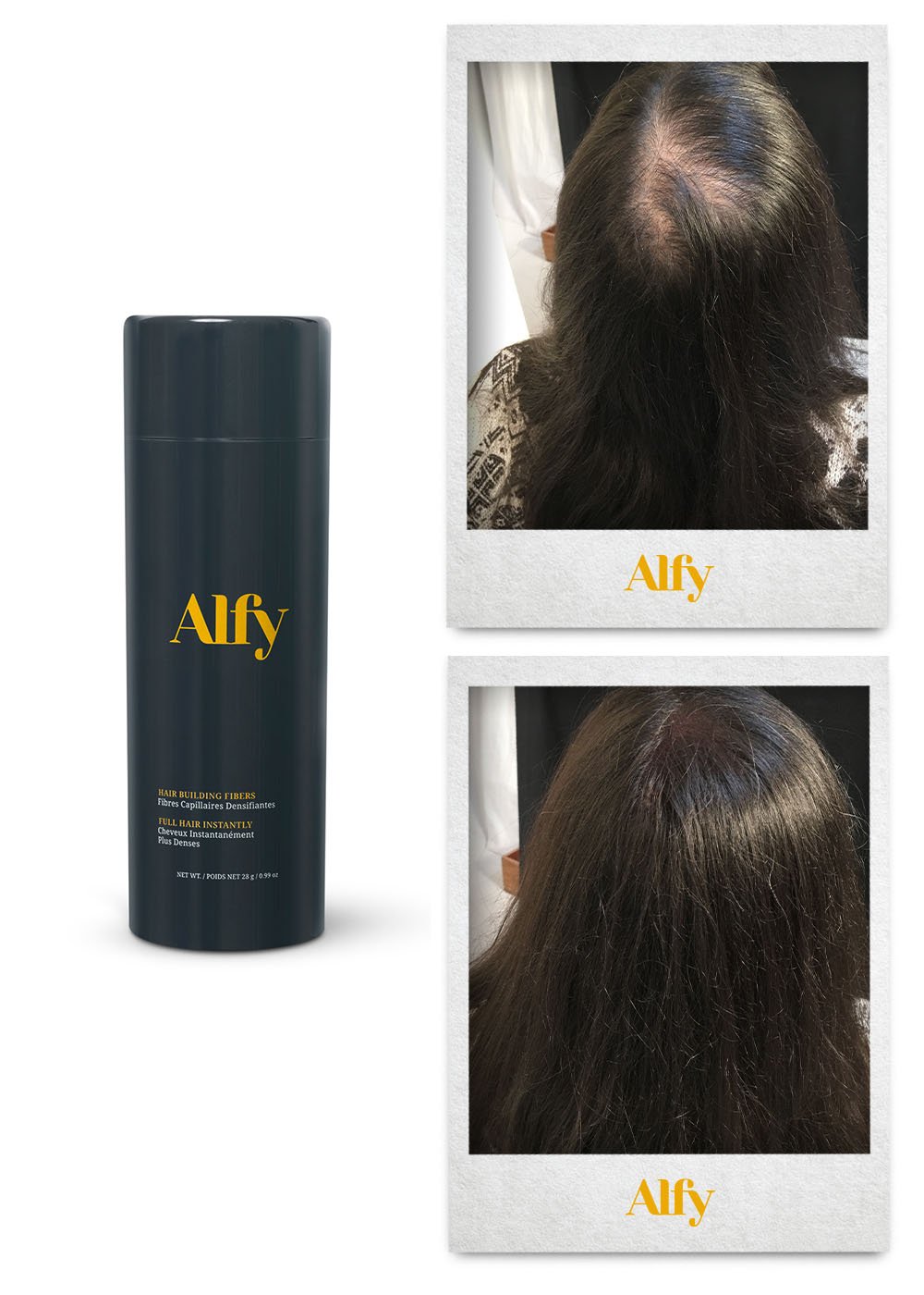 Alfy 28g Starter Kit featuring Hair Building Fibers, Fiber Lock Hair Spray, and Hairline Optimizer for fuller hair.