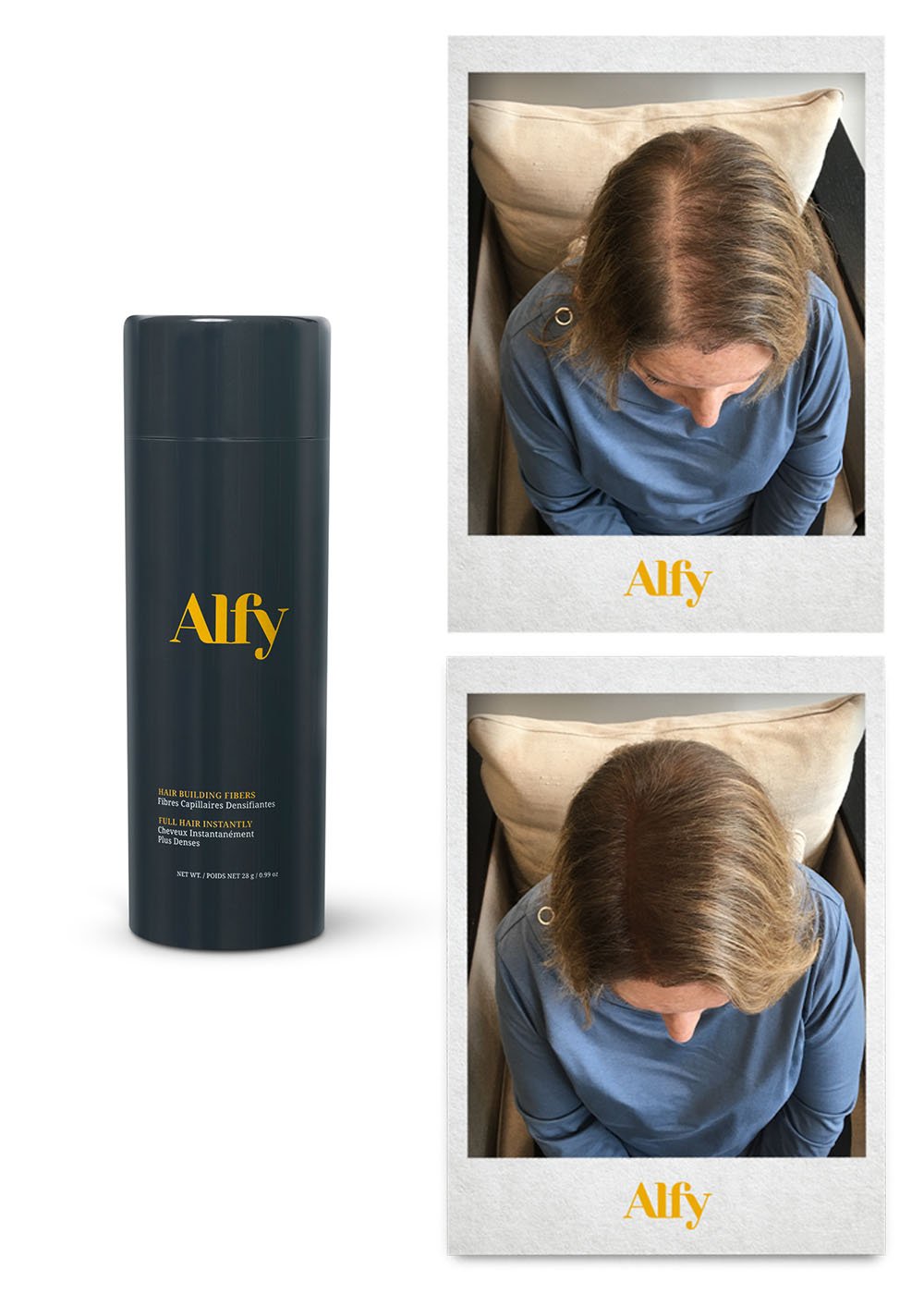 Alfy 28g Starter Kit featuring Hair Building Fibers, Fiber Lock Hair Spray, and Hairline Optimizer for fuller hair.