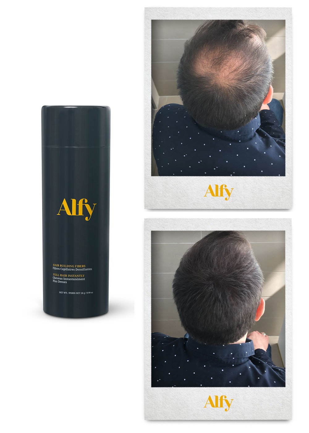 Alfy 28g Starter Kit featuring Hair Building Fibers, Fiber Lock Hair Spray, and Hairline Optimizer for fuller hair.