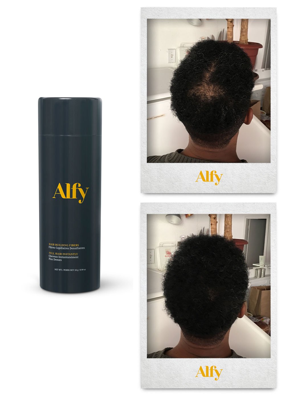 Alfy 28g Starter Kit featuring Hair Building Fibers, Fiber Lock Hair Spray, and Hairline Optimizer for fuller hair.