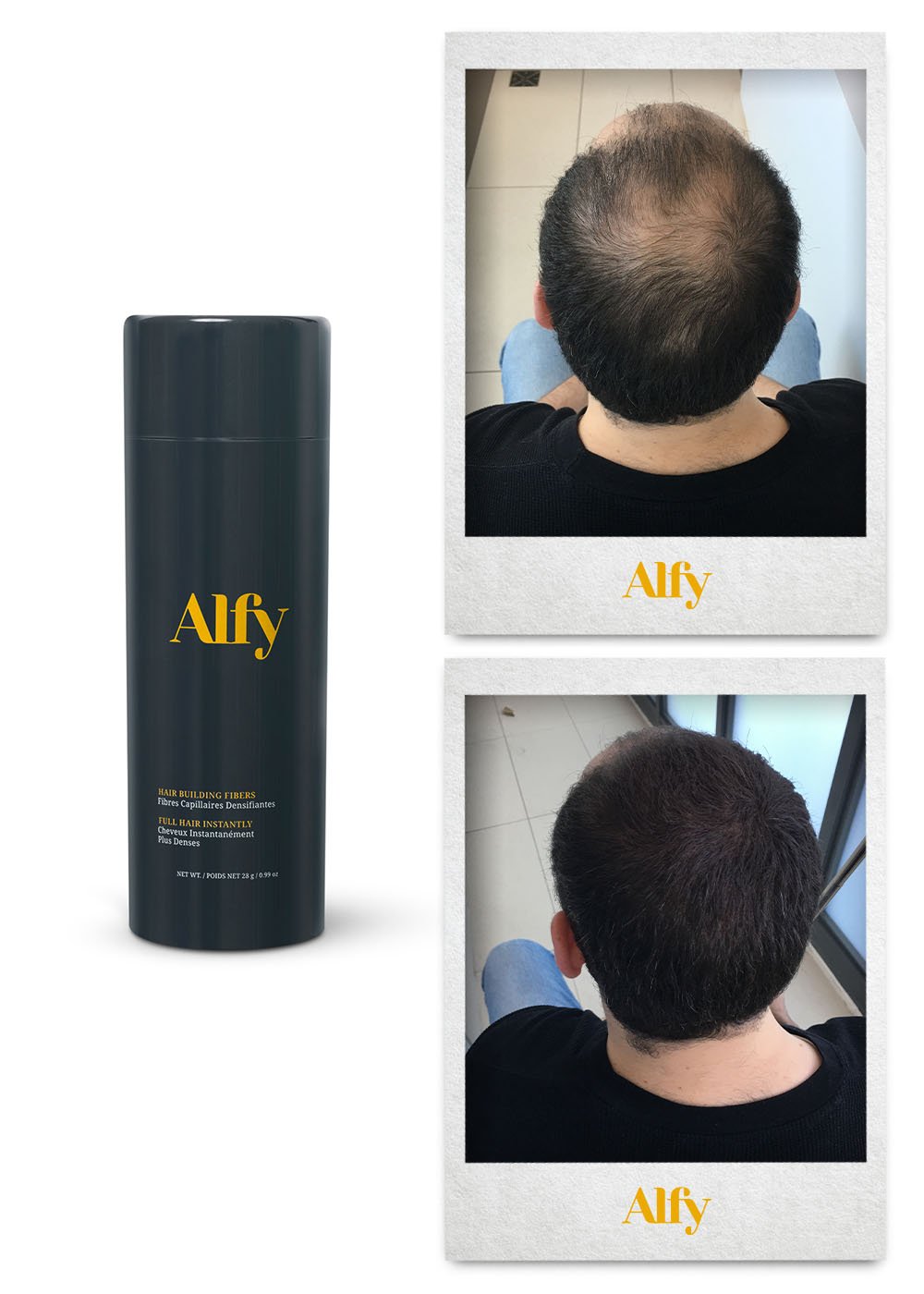 Alfy 28g Starter Kit featuring Hair Building Fibers, Fiber Lock Hair Spray, and Hairline Optimizer for fuller hair.