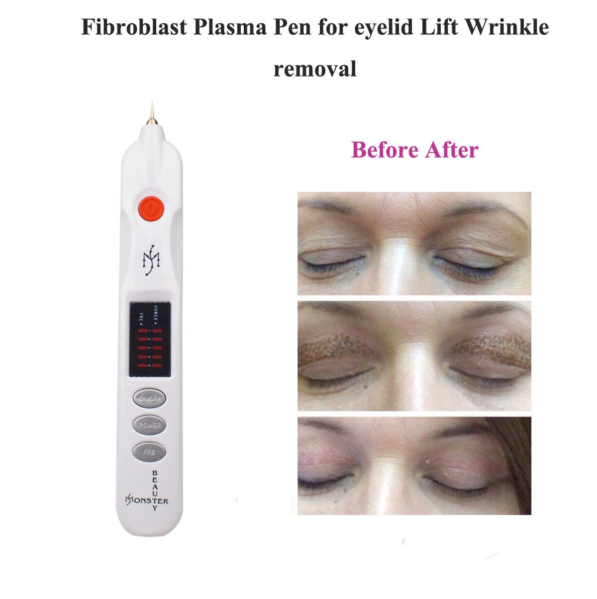 Professional Beauty Monster Fibroblast Plasma Pen in white color, designed for eyelid lifting and wrinkle removal, showcasing its sleek and ergonomic design.