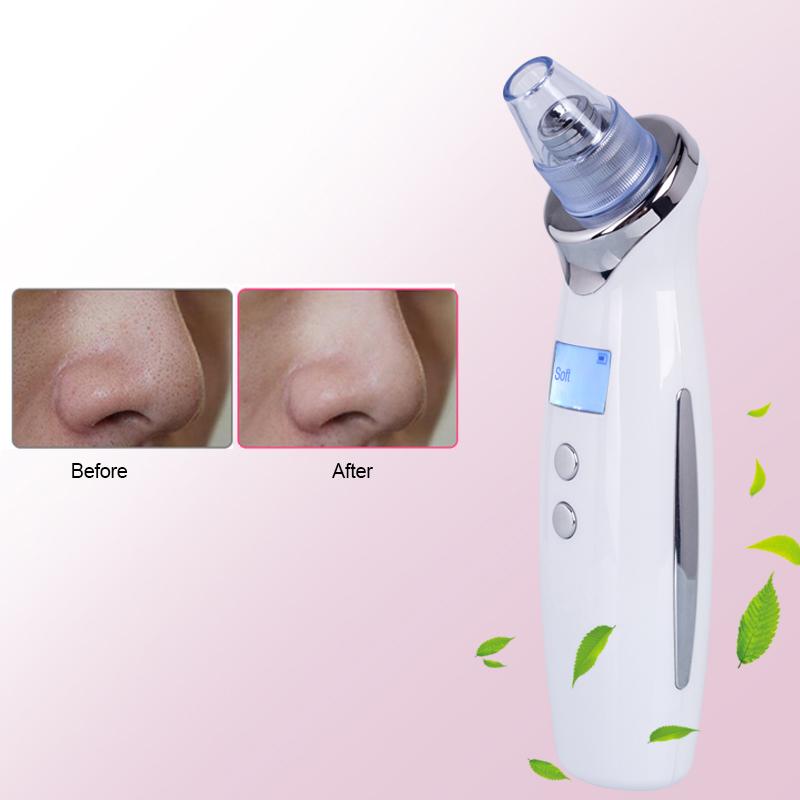 Face Pore Cleaner Blackhead Remover Vacuum with LCD display, designed for effective blackhead removal and skin exfoliation.