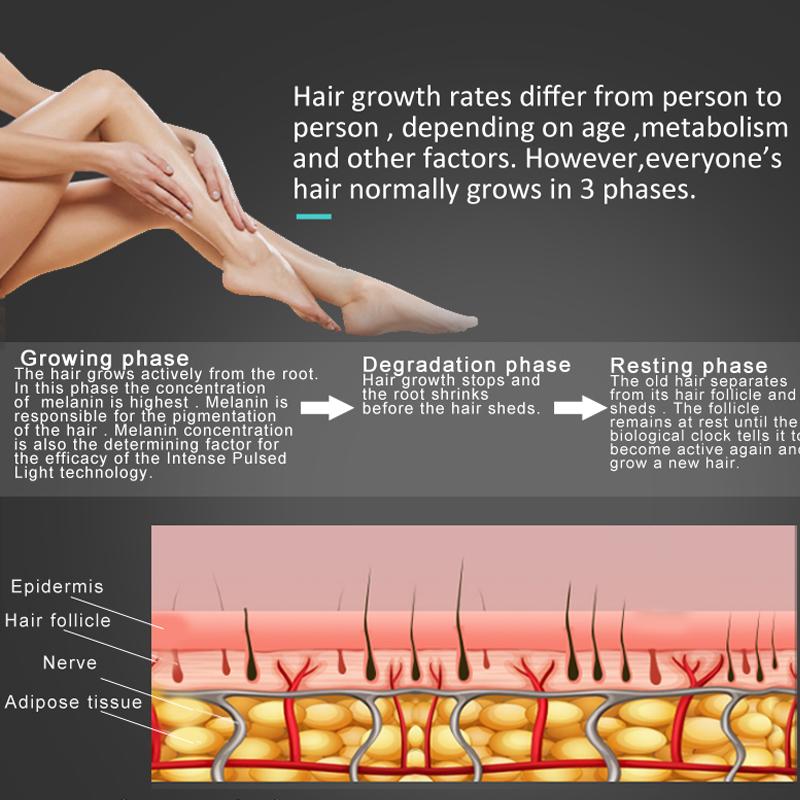 IPL Hair Remover Laser Depilator with LCD display for painless hair removal, suitable for body, bikini, and underarm areas.