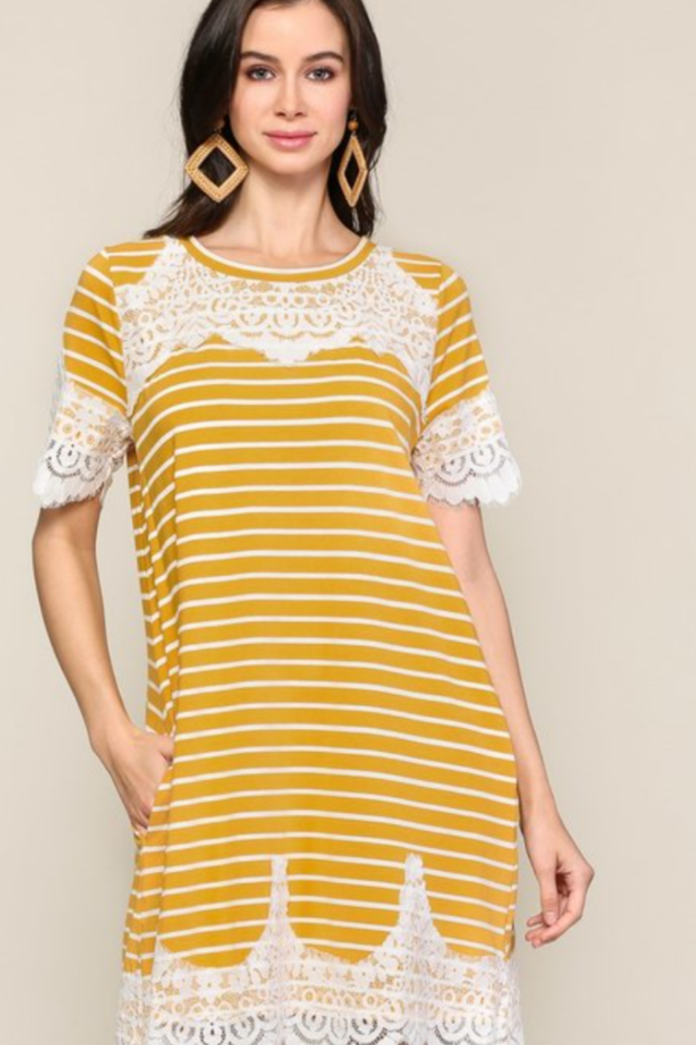 A stylish mustard dress featuring a striped pattern and intricate lace detailing at the front and back, perfect for various occasions.